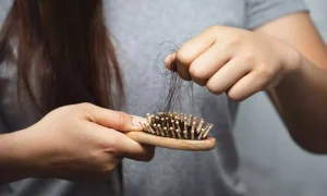 داروهای نوین برای جلوگیری از ریزش مو